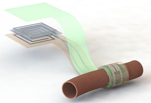 上圖描繪了這款可生物降解的壓力傳感器，它圍繞著一根血管，天線在左側(cè)(分離的層狀結(jié)構(gòu)，展示了天線結(jié)構(gòu)的細(xì)節(jié))